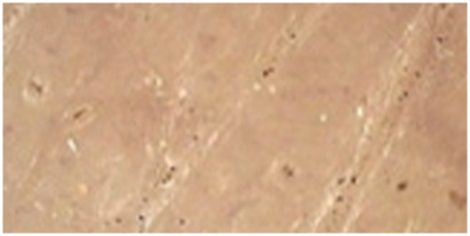 肌印象クリア効果