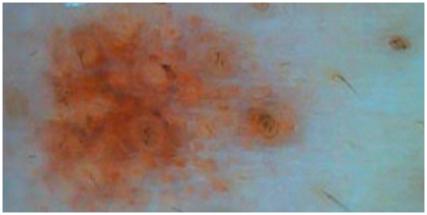 毛穴クレンジング効果