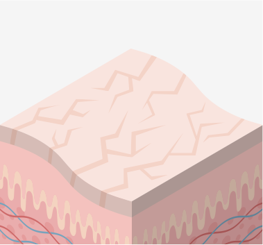 肌荒れイメージ