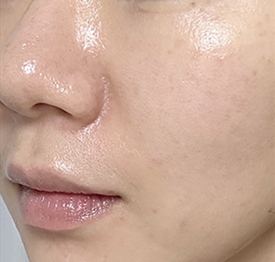 マックスグロウマスクご愛用者さまのお声01