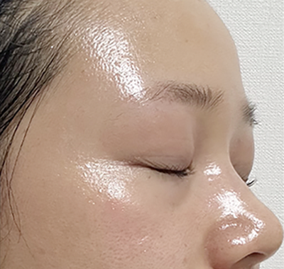 マックスグロウマスクご愛用者さまのお声02